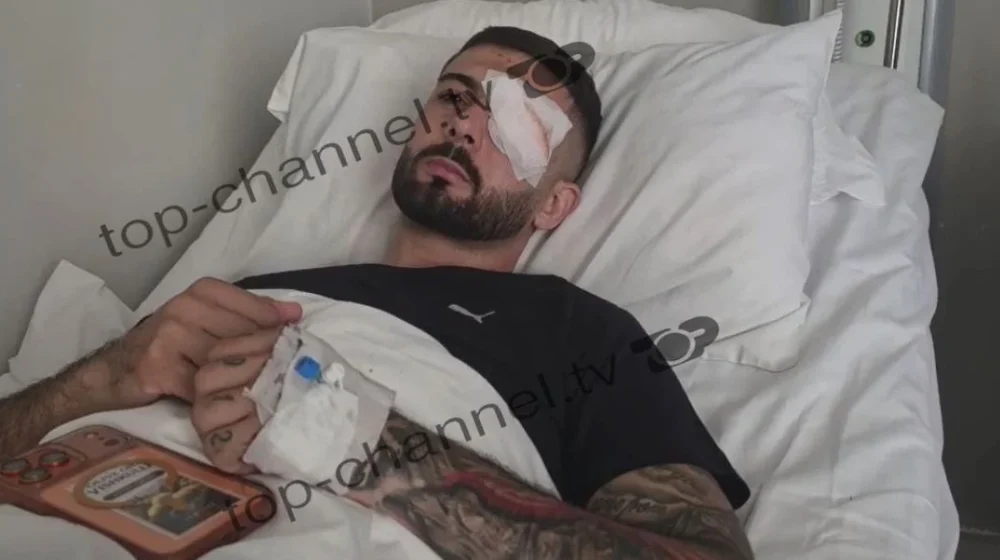 Erjon Vishkulli, plumbi i gomës mbetet në sy; niset për trajtim në Romë
